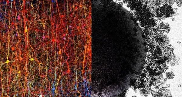 В мозгу человека обнаружены структуры, существующие в 11 измерениях
